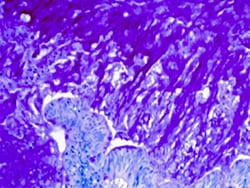 Diagnostic Biosystems&nbsp;MUCICARMINE Mucicarmine