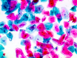 Diagnostic Biosystems PAPANICOLAOU RED STAIN KIT Papanicolaou Red Stain