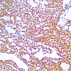 Diagnostic Biosystems&nbsp;OCT 3/4 OCT-3/4 (OCT4/6847R)