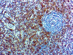 Diagnostic Biosystems&nbsp;CD7 CD7 (CBC.37.80)