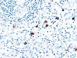 Diagnostic Biosystems&nbsp;IGM IgM