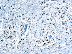 Diagnostic Biosystems&nbsp;CYCLIN D1 Cyclin D1 (SP4)