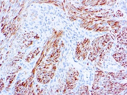 Diagnostic Biosystems&nbsp;MOUSE AND RABBIT LINK Desmin (D33)
