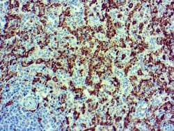 Diagnostic Biosystems&nbsp;LBA1 Iba1 (AIF1)