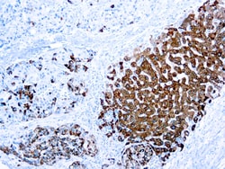 Diagnostic Biosystems HEPATOCYTE Hepatocyte Specific Antigen (OCH1E5),