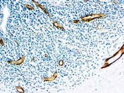 Diagnostic Biosystems&nbsp;FACTOR VIII R ANTIGEN Factor VIII Related Antigen/Von Willebrand Factor