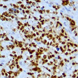 Diagnostic Biosystems MYOGENIN Myogenin, Quantity: Each of 1