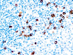 Diagnostic Biosystems&nbsp;IGA IgA