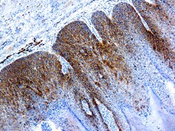 Diagnostic Biosystems&nbsp;HPV16 HPV 16