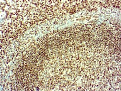 Diagnostic Biosystems&nbsp;ATRX ATRX (D-5)