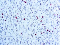 Diagnostic Biosystems PHOSPHOHISTONE H3 PHH3 Phosphohistone H3 (PHH3),