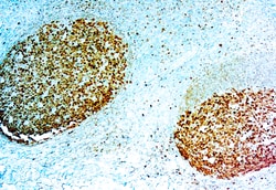 Diagnostic Biosystems&nbsp;BOB1 BOB.1 (SP92)