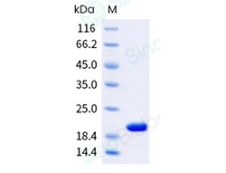 Sino Biological Recombinant Mouse alpha-Synuclein Protein (His Tag), HPLC-verified,