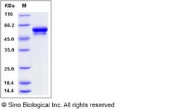 Sino Biological Human VIM Protein 1MG 10028-H08B-1, Quantity: Each of 1