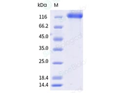 Sino Biological Human FLT3 Protein 100UG 10445-H41H-B-100, Quantity: Each