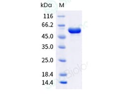 Sino Biological Influenza A H1N1 (A/Wisconsin/67/2022) Nucleoprotein/NP