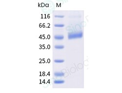 Sino Biological Human A2aR -Nanodisc Protein(His & Flag Tag), Quantity: