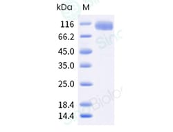 Sino Biological Recombinant Human ICAM-1/CD54 Protein (ECD, hFc Tag), HPLC-verified,