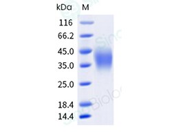 Sino Biological Recombinant Mouse CD47 Protein (His & AVI Tag), Biotinylated,