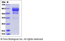 Sino Biological Recombinant Human PSAP/Prosaposin Protein (His Tag), HPLC-verified,