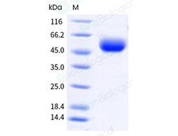 Sino Biological Recombinant Human IL-18R beta / IL-18RAP Protein (His &