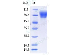 Sino Biological Recombinant Human FGFR2 Protein (ECD, alpha(IIIb), His