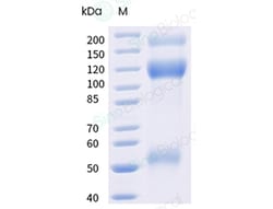 Sino Biological Recombinant Human IGF1R Protein (ECD, His & AVI Tag), Biotinylated,