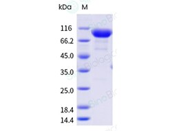 Sino Biological Recombinant Human IL-18R beta / IL-18RAP Protein (hFc &