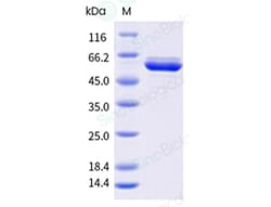 Sino Biological Influenza A H1N1 (A/Sydney/5/2021) Nucleoprotein / NP Protein