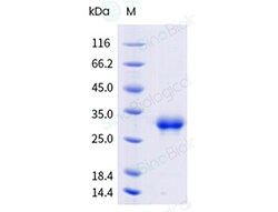 Sino Biological Recombinant Human CD8 alpha Protein (ECD, His & AVI Tag),