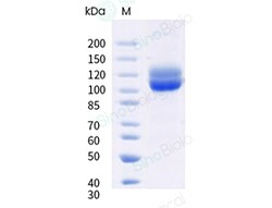Sino Biological Recombinant Human CD203c/ENPP-3 Protein (ECD, His Tag),