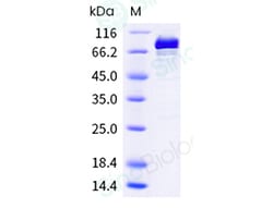 Sino Biological Recombinant Mouse TOP1 Protein (His Tag), HPLC-verified,
