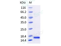 Sino Biological Recombinant Human GDNF Protein, HPLC-verified, Quantity: