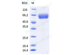 Sino Biological Recombinant Human FGFR3 Protein (ECD, alpha IIIb, His Tag),