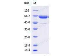 Sino Biological Influenza A H1N1 (A/Sydney/5/2021) Neuraminidase / NA Protein