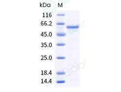 Sino Biological Human Papilloma Virus type 18 (HPV 18) L1 protein (VLP),