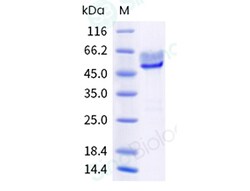 Sino Biological Recombinant Human Syndecan-1/CD138 Protein (ECD, His &