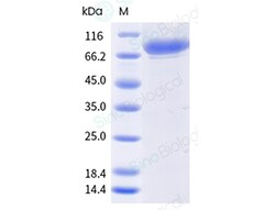 Sino Biological Recombinant Human Carbonic Anhydrase IX/CA9 Protein (ECD,