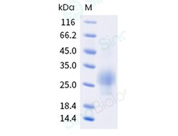 Sino Biological Recombinant Human ICOS Protein (His Tag), HPLC-verified,