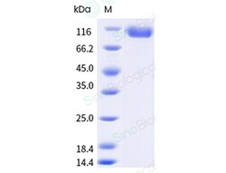 Sino Biological Recombinant Human FAP Protein (ECD, His & AVI Tag), Biotinylated,