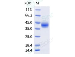 Sino Biological Recombinant Mouse 4-1BB/CD137 Protein (His & AVI Tag),