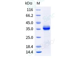 Sino Biological Recombinant Mouse PU.1/SPI1 Protein (His Tag), Quantity: