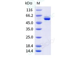 Sino Biological Influenza A H3N2 (A/Panama/2007/99) Nucleoprotein / NP