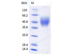 Sino Biological Recombinant Human CD89/FCAR Protein (ECD, His & AVI Tag),