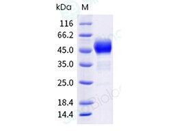 Sino Biological Recombinant Human CD63 Protein (hFc Tag), HPLC-verified,