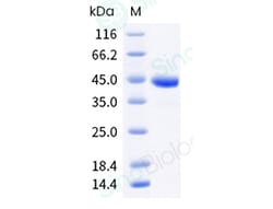 Sino Biological Influenza A H5N8 (A/Astrakhan/3212/2020) Hemagglutinin