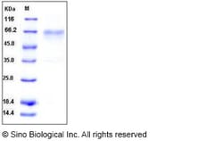 Sino Biological Recombinant Mouse HVEM Protein (His & hFc Tag), Quantity: