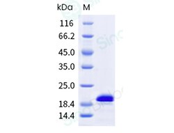 Sino Biological Recombinant Human alpha-Synuclein Protein (His Tag), Quantity: