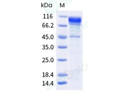 Sino Biological Recombinant Human Cadherin-17 Protein (ECD, His & AVI Tag),