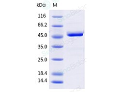 Sino Biological Recombinant Human SMYD3 Protein (His & FLAG Tag), Quantity: